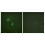 Immunofluorescence - Anti-Estrogen Receptor-alpha (phospho Ser305) Antibody (A0921) - Antibodies.com