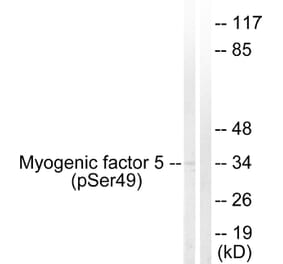 Western Blot - Anti-Myogenic Factor 5 (phospho Ser49) Antibody (A1218) - Antibodies.com