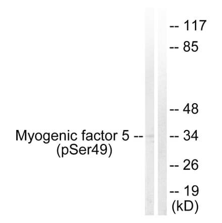 Western Blot - Anti-Myogenic Factor 5 (phospho Ser49) Antibody (A1218) - Antibodies.com