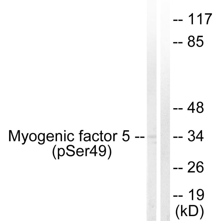 Western Blot - Anti-Myogenic Factor 5 (phospho Ser49) Antibody (A1218) - Antibodies.com