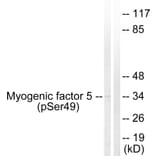 Western Blot - Anti-Myogenic Factor 5 (phospho Ser49) Antibody (A1218) - Antibodies.com