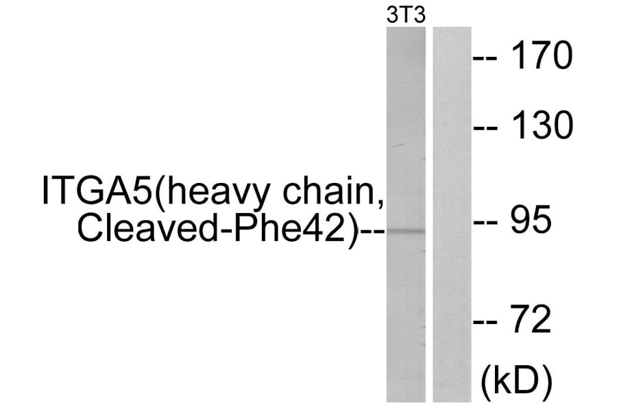 Western Blot - Anti-ITGA5 (heavy chain,cleaved Phe42) Antibody (L0277) - Antibodies.com