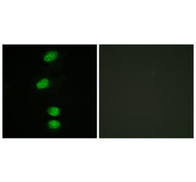 Immunofluorescence - Anti-Androgen Receptor (phospho Ser94) Antibody (A0767) - Antibodies.com