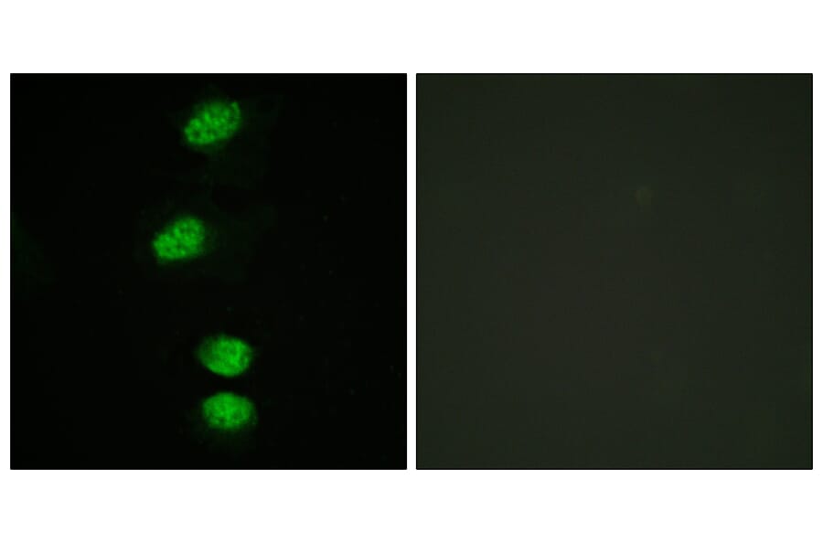 Immunofluorescence - Anti-Androgen Receptor (phospho Ser94) Antibody (A0767) - Antibodies.com