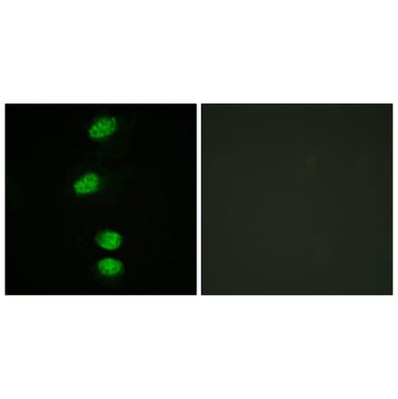 Immunofluorescence - Anti-Androgen Receptor (phospho Ser94) Antibody (A0767) - Antibodies.com