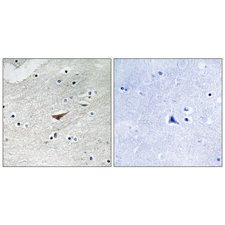 Immunohistochemistry - Anti-VE-Cadherin (phospho Tyr731) Antibody (A8251) - Antibodies.com