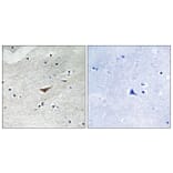 Immunohistochemistry - Anti-VE-Cadherin (phospho Tyr731) Antibody (A8251) - Antibodies.com
