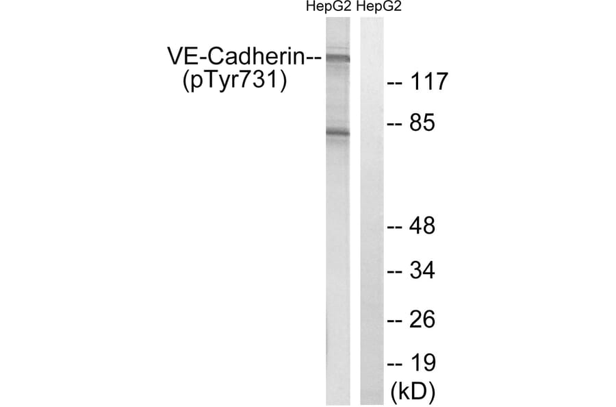 Western Blot - Anti-VE-Cadherin (phospho Tyr731) Antibody (A8251) - Antibodies.com