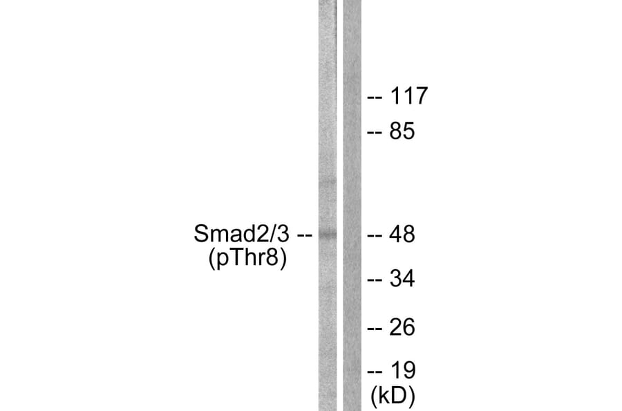 Western Blot - Anti-Smad2 + Smad3 (phospho Thr8) Antibody (A1001) - Antibodies.com