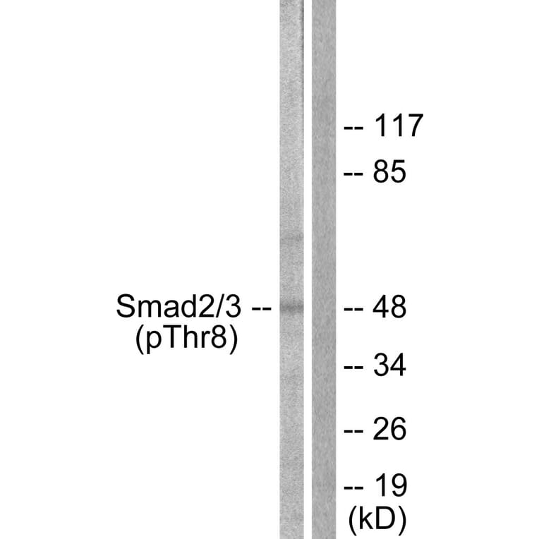 Western Blot - Anti-Smad2 + Smad3 (phospho Thr8) Antibody (A1001) - Antibodies.com