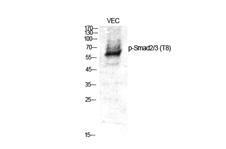 Western Blot - Anti-Smad2 + Smad3 (phospho Thr8) Antibody (A1001) - Antibodies.com