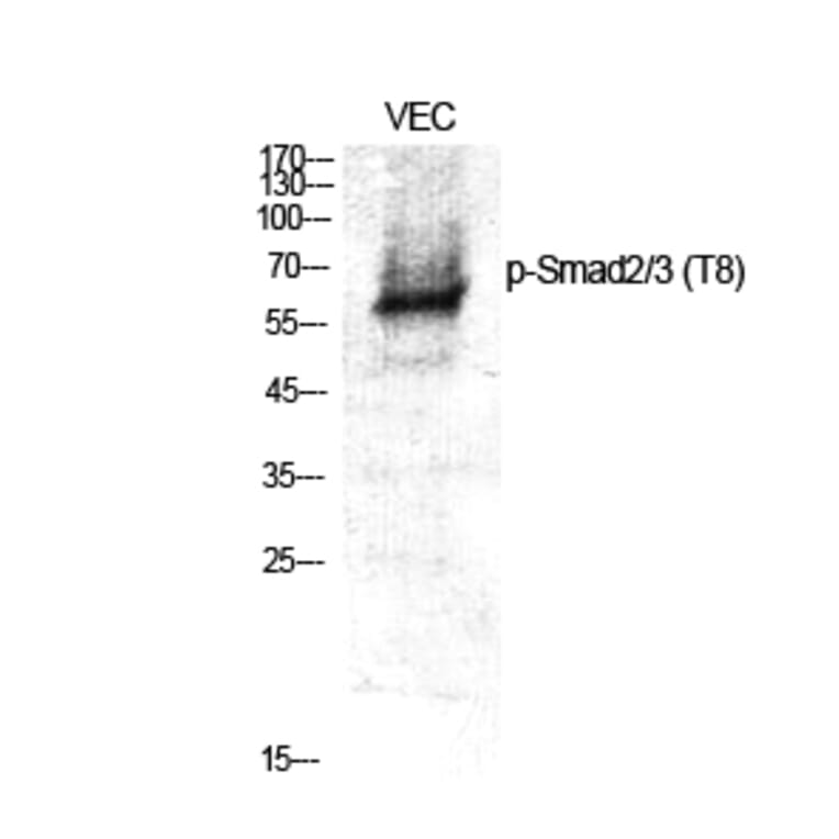 Western Blot - Anti-Smad2 + Smad3 (phospho Thr8) Antibody (A1001) - Antibodies.com
