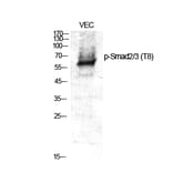 Western Blot - Anti-Smad2 + Smad3 (phospho Thr8) Antibody (A1001) - Antibodies.com