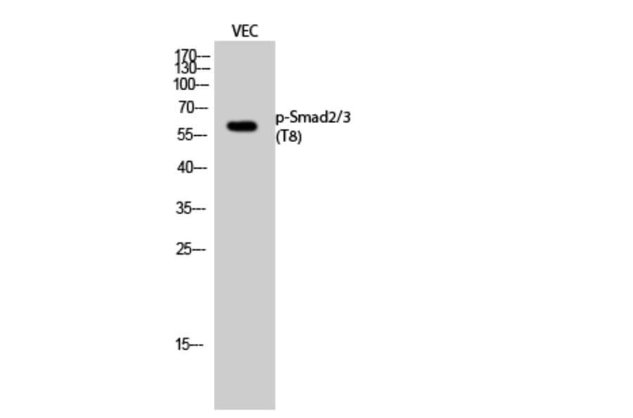 Western Blot - Anti-Smad2 + Smad3 (phospho Thr8) Antibody (A1001) - Antibodies.com