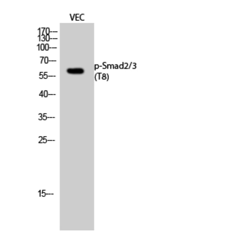 Western Blot - Anti-Smad2 + Smad3 (phospho Thr8) Antibody (A1001) - Antibodies.com