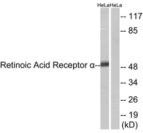 Western Blot - Anti-Retinoic Acid Receptor alpha Antibody (B8217) - Antibodies.com