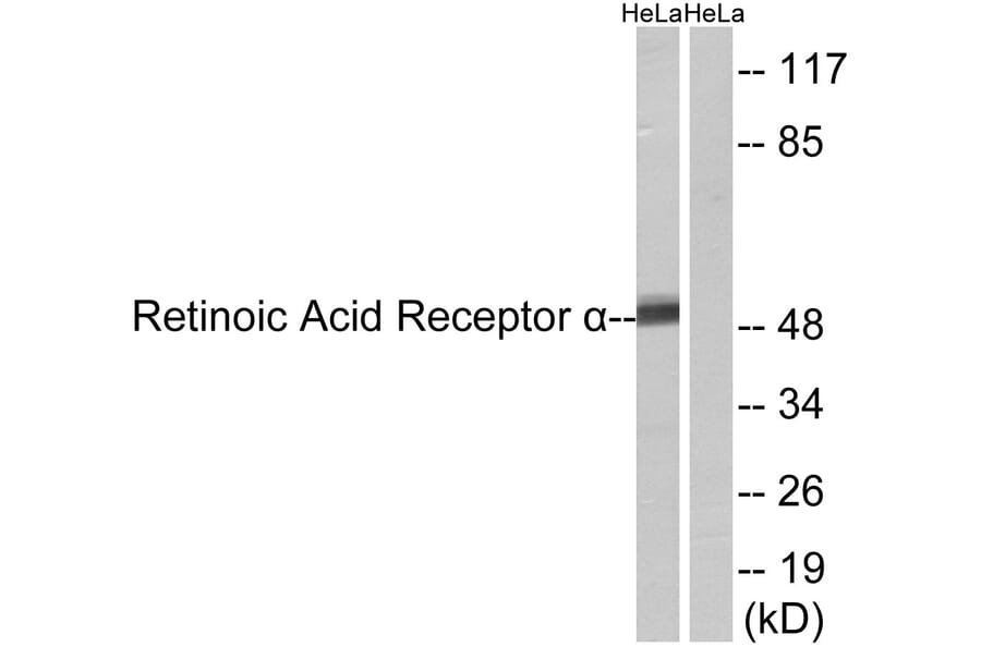 Western Blot - Anti-Retinoic Acid Receptor alpha Antibody (B8217) - Antibodies.com