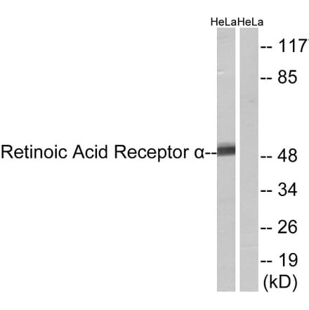 Western Blot - Anti-Retinoic Acid Receptor alpha Antibody (B8217) - Antibodies.com