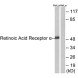 Western Blot - Anti-Retinoic Acid Receptor alpha Antibody (B8217) - Antibodies.com