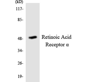 Western Blot - Anti-Retinoic Acid Receptor alpha Antibody (R12-3424) - Antibodies.com
