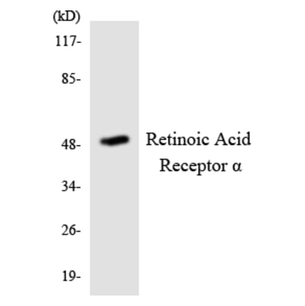 Western Blot - Anti-Retinoic Acid Receptor alpha Antibody (R12-3424) - Antibodies.com