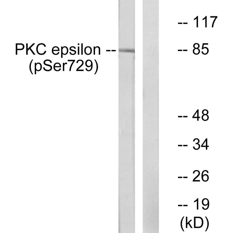Western Blot - Anti-PKC epsilon (phospho Ser729) Antibody (A0802) - Antibodies.com