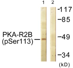 Western Blot - Anti-PKA-R2 beta (phospho Ser113) Antibody (A0972) - Antibodies.com