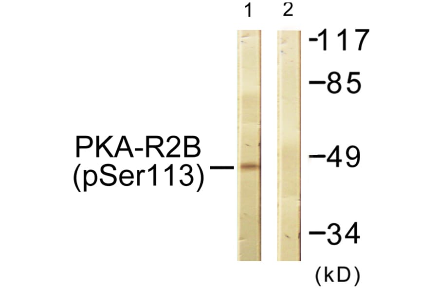Western Blot - Anti-PKA-R2 beta (phospho Ser113) Antibody (A0972) - Antibodies.com