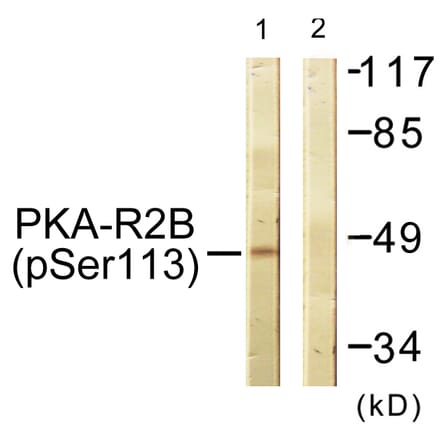 Western Blot - Anti-PKA-R2 beta (phospho Ser113) Antibody (A0972) - Antibodies.com