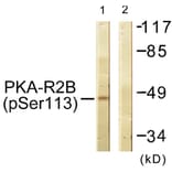 Western Blot - Anti-PKA-R2 beta (phospho Ser113) Antibody (A0972) - Antibodies.com