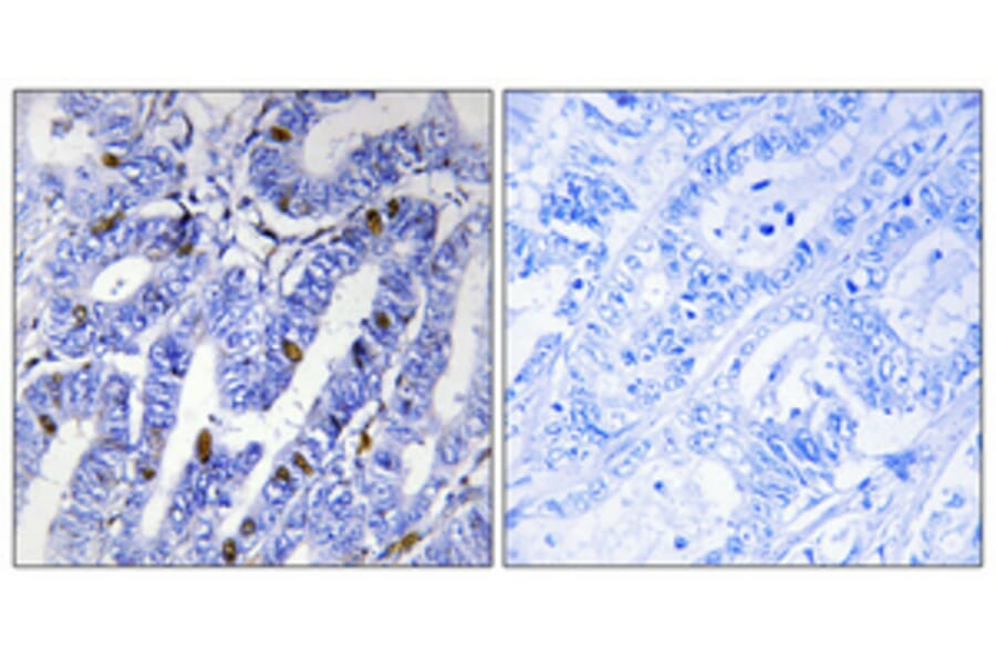 Immunohistochemistry - Anti-PKA-R2 beta (phospho Ser113) Antibody (A0972) - Antibodies.com