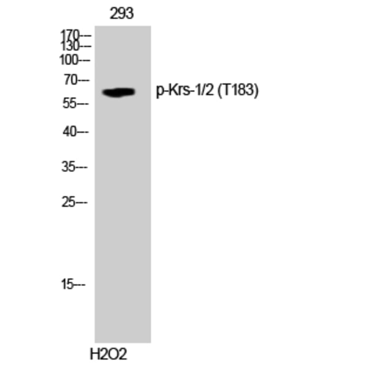 Western Blot - Anti-Mst1 + Mst2 (phospho Thr183) Antibody (A0687) - Antibodies.com