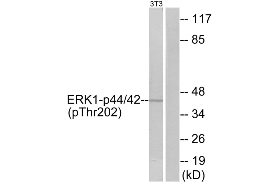 Western Blot - Anti-ERK1 + ERK2 (phospho Thr202) Antibody (A7073) - Antibodies.com