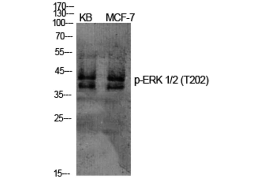 Western Blot - Anti-ERK1 + ERK2 (phospho Thr202) Antibody (A7073) - Antibodies.com