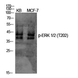 Western Blot - Anti-ERK1 + ERK2 (phospho Thr202) Antibody (A7073) - Antibodies.com