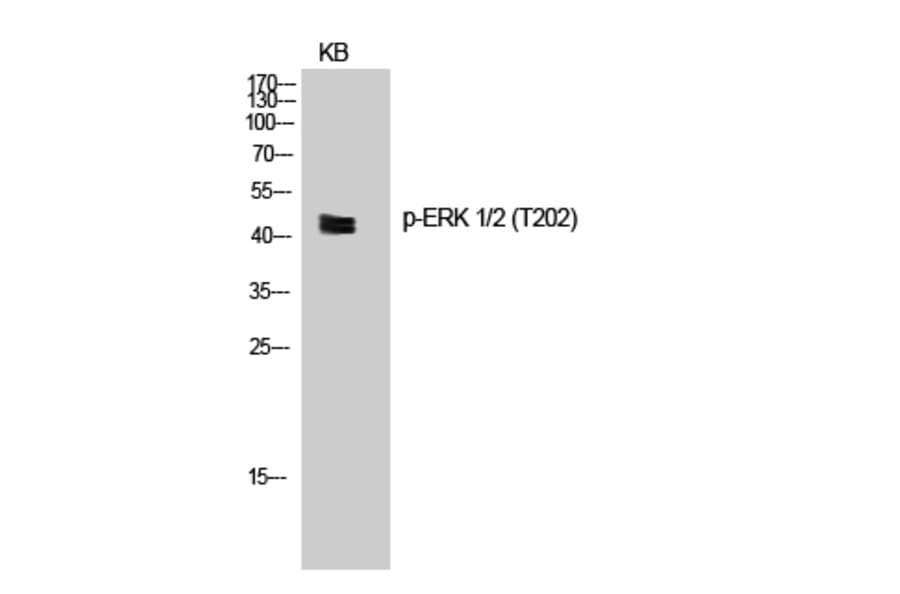 Western Blot - Anti-ERK1 + ERK2 (phospho Thr202) Antibody (A7073) - Antibodies.com