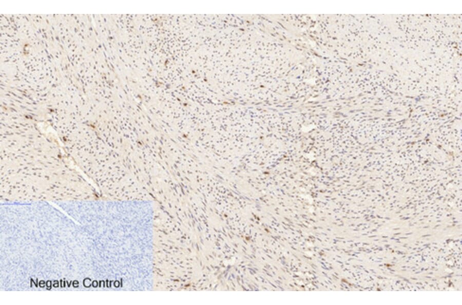 Immunohistochemistry - Anti-ERK1 + ERK2 (phospho Thr202) Antibody (A7073) - Antibodies.com
