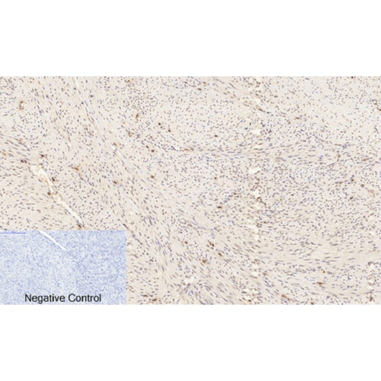 Immunohistochemistry - Anti-ERK1 + ERK2 (phospho Thr202) Antibody (A7073) - Antibodies.com