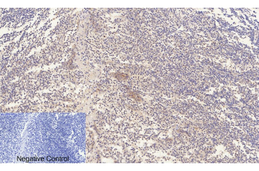 Immunohistochemistry - Anti-ERK1 + ERK2 (phospho Thr202) Antibody (A7073) - Antibodies.com