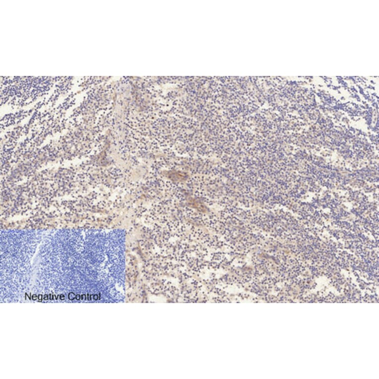 Immunohistochemistry - Anti-ERK1 + ERK2 (phospho Thr202) Antibody (A7073) - Antibodies.com