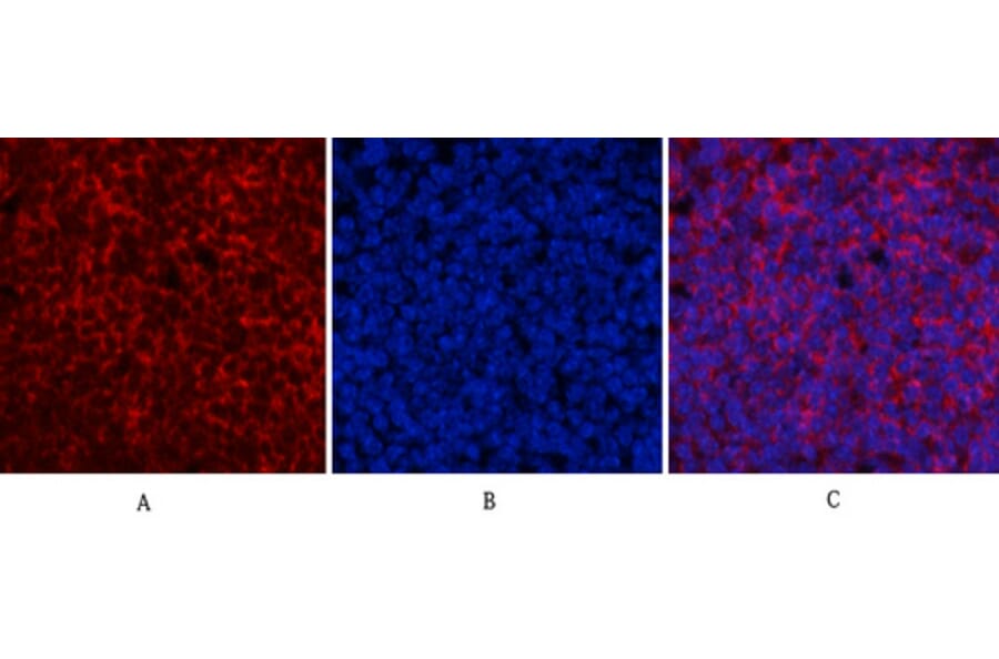 Immunofluorescence - Anti-ERK1 + ERK2 (phospho Thr202) Antibody (A7073) - Antibodies.com