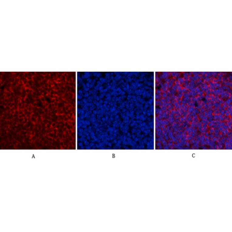Immunofluorescence - Anti-ERK1 + ERK2 (phospho Thr202) Antibody (A7073) - Antibodies.com
