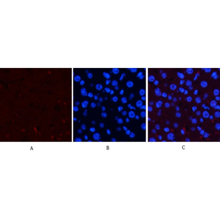 Immunofluorescence - Anti-ERK1 + ERK2 (phospho Thr202) Antibody (A7073) - Antibodies.com