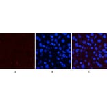 Immunofluorescence - Anti-ERK1 + ERK2 (phospho Thr202) Antibody (A7073) - Antibodies.com