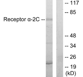 Western Blot - Anti-Adrenergic Receptor alpha-2C Antibody (C10418) - Antibodies.com
