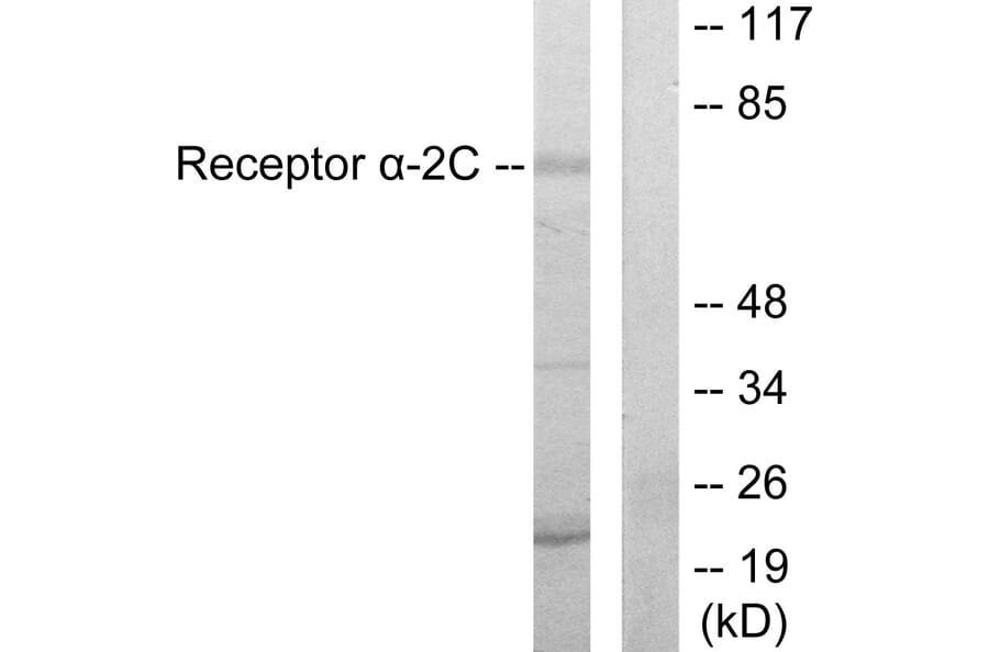 Western Blot - Anti-Adrenergic Receptor alpha-2C Antibody (C10418) - Antibodies.com