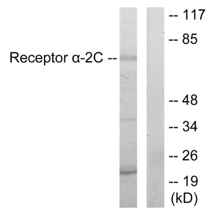 Western Blot - Anti-Adrenergic Receptor alpha-2C Antibody (C10418) - Antibodies.com