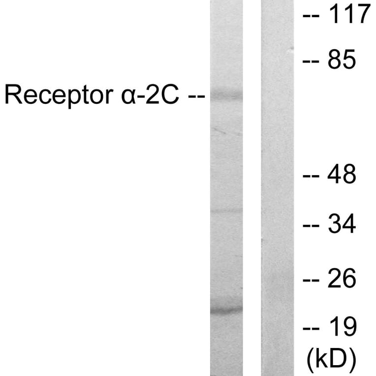 Western Blot - Anti-Adrenergic Receptor alpha-2C Antibody (C10418) - Antibodies.com