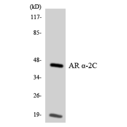 Western Blot - Anti-Adrenergic Receptor alpha-2C Antibody (R12-2459) - Antibodies.com