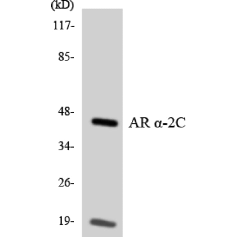 Western Blot - Anti-Adrenergic Receptor alpha-2C Antibody (R12-2459) - Antibodies.com